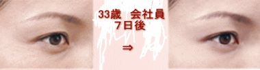 アルジェ50